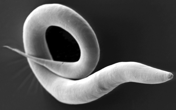 The Effect of Different Fructose Diets on the Lifespan of <em>C. elegans</em>