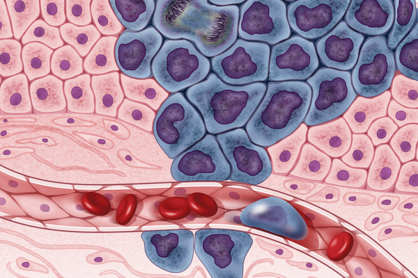 Significance of Tumor Growth Modeling in the Behavior of Homogeneous Cancer Cell Populations: Are Tumor Growth Models Applicable to Both Heterogeneous and Homogeneous Populations?