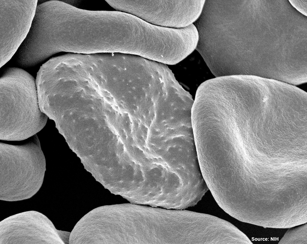 Machine learning for the diagnosis of malaria: a pilot study of transfer learning techniques