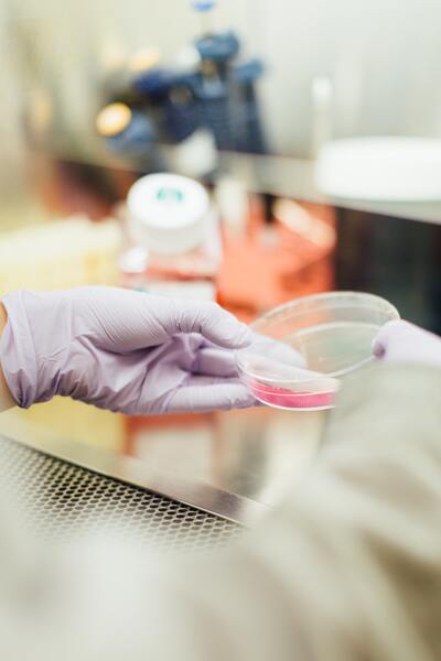 Wound healing properties of mesenchymal conditioned media: Analysis of PDGF, VEGF and IL-8 concentrations