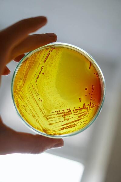 Effect of environment factors on the expression of soluble PDE8A1 in <em>E. coli</em>