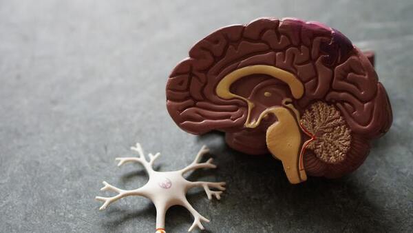 Association of agenesis of the corpus callosum with epilepsy and anticonvulsant drug treatment 