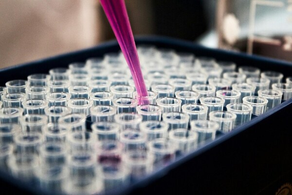 Genetic underpinnings of the sex bias in autism spectrum disorder