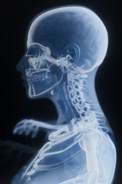 The effects of image manipulation on classification of cervical spondylosis X-ray images using deep learning
