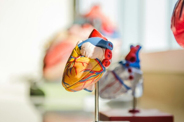 Quantifying right atrial dilation relative to atrial septal defect size using an experimental model