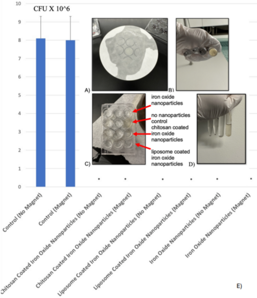 Iron oxide nanoparticles coated with liposomes and chitosan pass a model blood–brain barrier to kill bacteria