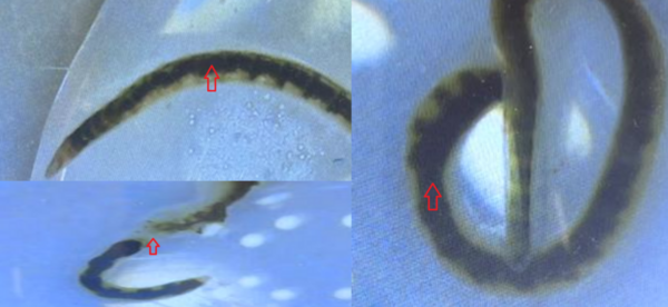 Regenerative Effects of Turmeric and Alpha-Lipoic Acid in <i>Lumbriculus variegatus</i>